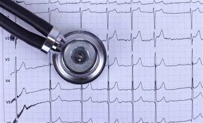 quel examen cardiaque choisir